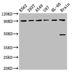 Polyclonal Rabbit anti-Human OCA2 / P protein Antibody (WB)