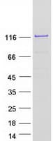 Human CFAP70 / TTC18 Protein (Recombinant Myc-DDK (Flag))