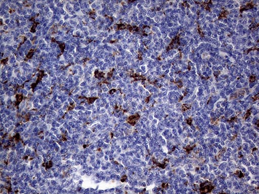 Monoclonal Mouse anti-Human CTSL / Cathepsin L Antibody (clone OTI2H2, IHC, WB)