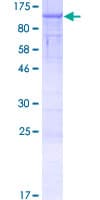 Human CASC1 Protein (Recombinant GST)