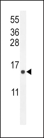 ATP6V0B Antibody (aa104-131)