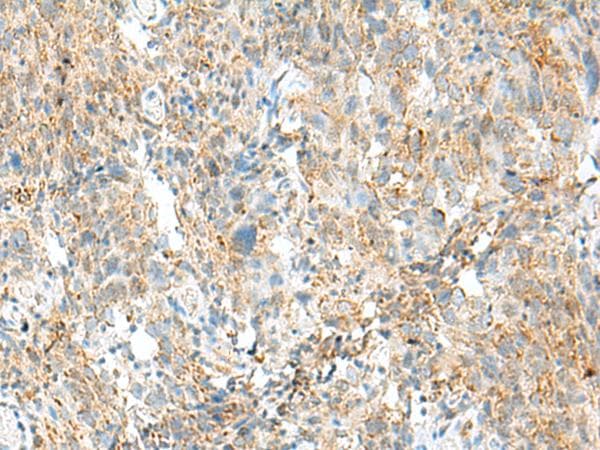 MCCC1 Antibody