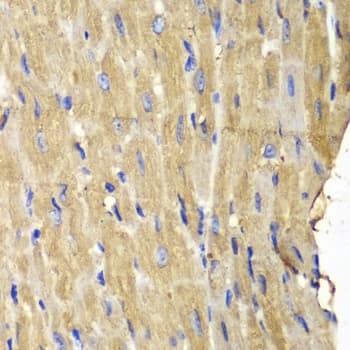 PLCG2 / PLC Gamma 2 Antibody