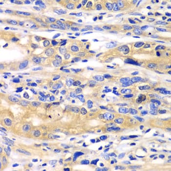 Polyclonal Rabbit anti-Human SARS / Serine-tRNA Ligase Antibody (IHC, IF, WB)
