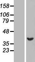 SERPINB1 Protein (Over-Expression Lysate Myc-DDK (Flag))