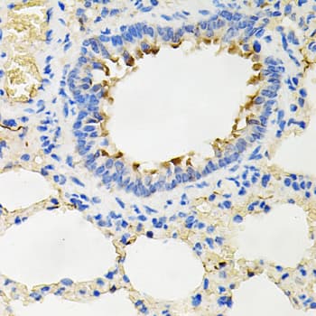 IRAK2 / IRAK-2 Antibody