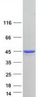 Human TNNT2 / CTNT Protein (Recombinant Myc-DDK (Flag))