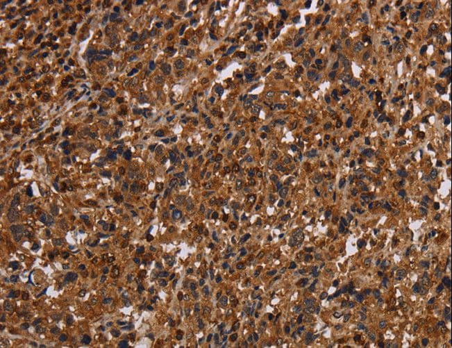 MAGEC2 / CT10 Antibody
