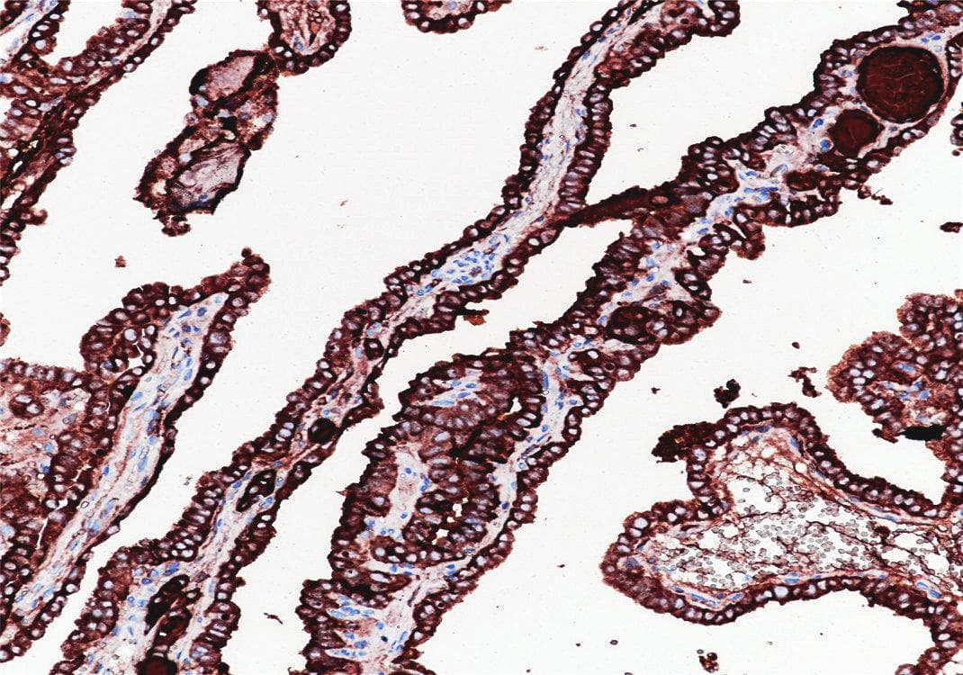 Monoclonal Mouse anti-Human TG / Thyroglobulin Antibody (IHC)