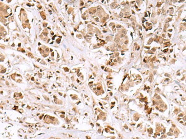 INSM1 Antibody