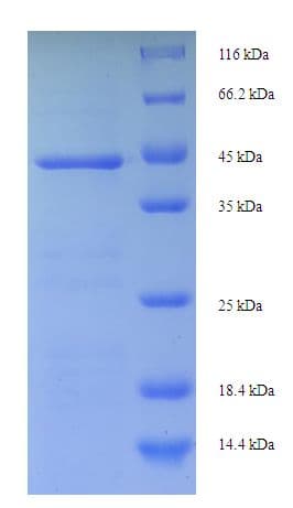 Drimia maritima Ribosome-inactivating Protein Charybdin (Recombinant His-SUMO)