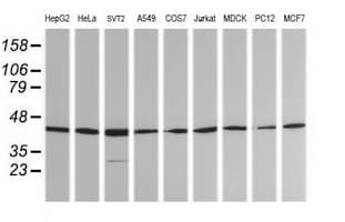 MAP2K1 / MKK1 / MEK1 Antibody (clone OTI8H1)
