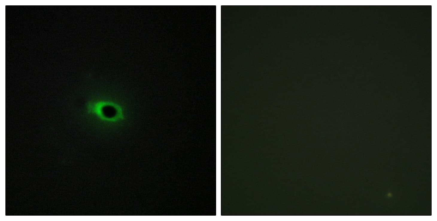 Collagen XII Alpha 1 Antibody (aa1481-1530)