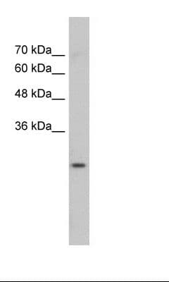 GSTM1 Antibody (aa31-80)