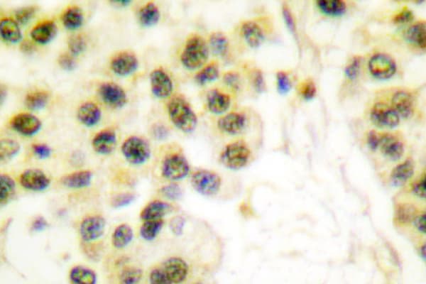 CCNB1 / Cyclin B1 Antibody (Ile120)