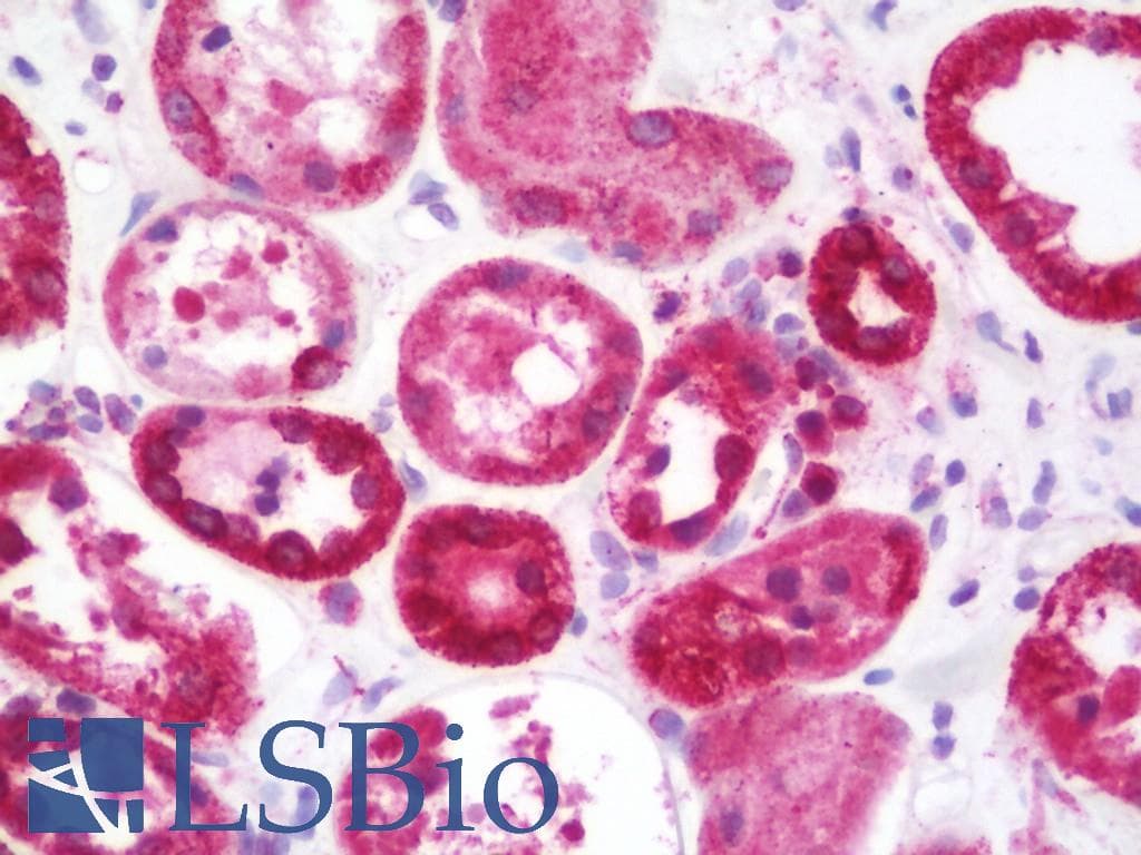 IHC-plus™ STUB1 / CHIP Antibody (aa253-303)