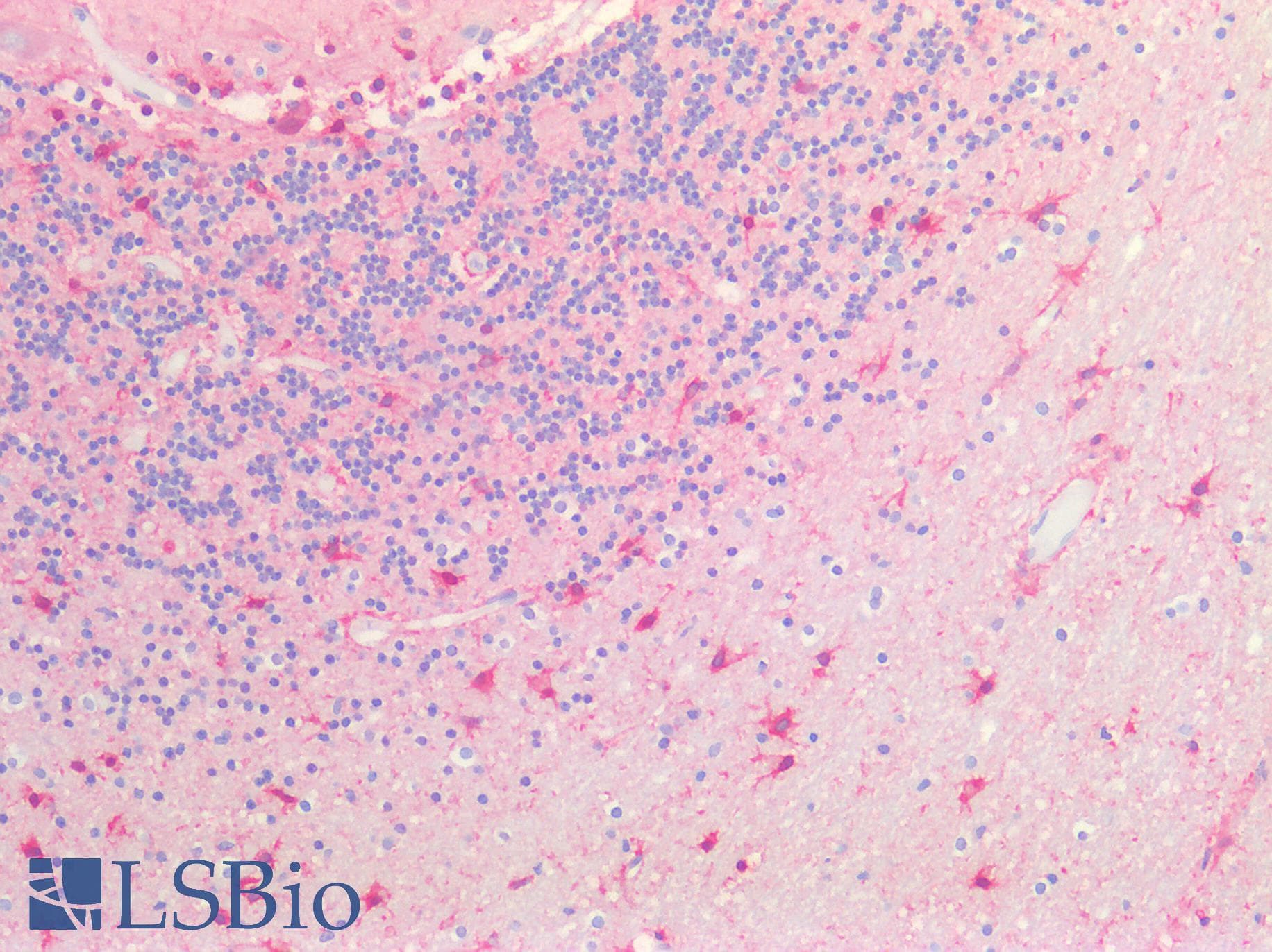 IHC-plus™ Polyclonal Rabbit anti-Human GABARAPL2 / ATG8 Antibody (IHC, IF, WB)