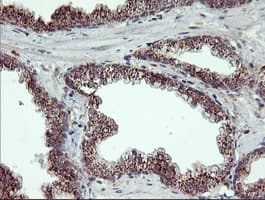 RLBP1 / CRALBP Antibody (clone OTI1G6)
