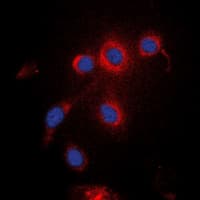 UBXN11 / SOC Antibody (Internal)