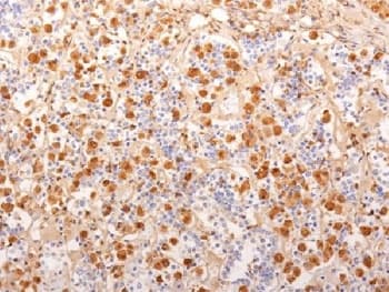 Monoclonal Mouse anti-Human ACTH Antibody (clone 2F6, Azide-free,BSA-free, aa1-24, IHC, IF, WB)