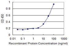 Monoclonal Mouse anti-Human VDAC3 Antibody (clone 1C6)