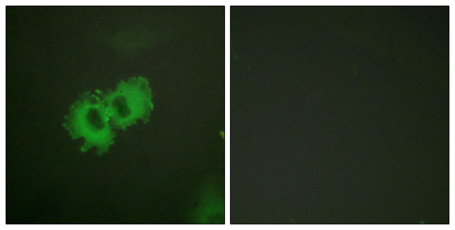 CALD1 / Caldesmon Antibody (phospho-Ser789)