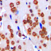 ITGAV/Integrin Alpha V/CD51 Antibody (C-Terminus)