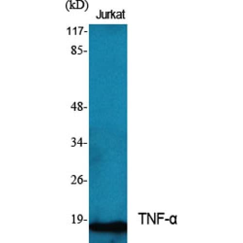 Polyclonal Rabbit anti-Human TNF Alpha Antibody (110-190 aa, Internal, IHC, IF, WB)