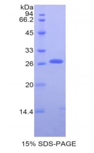 Human CD71 / Transferrin Receptor Protein (Recombinant His-S)