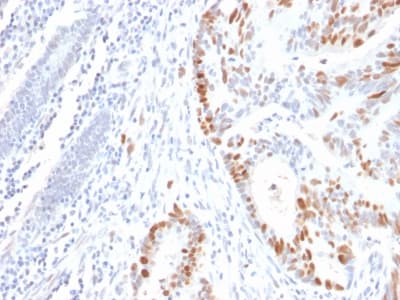 PathPlus™ TP53 / p53 Antibody (clone rBP53-12)