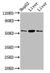 GPT / Alanine Transaminase Antibody (aa2-496)