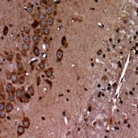 RARA / RAR Alpha Antibody