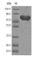 Agrobacterium 3-phosphoshikimate 1-carboxyvinyltransferase Protein (Recombinant 6His, N-terminus)
