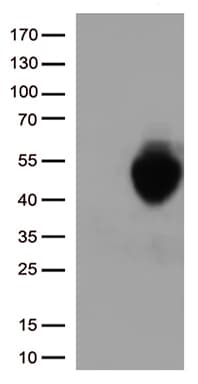 CD274 / B7-H1 / PD-L1 Antibody (clone OTI7D4)