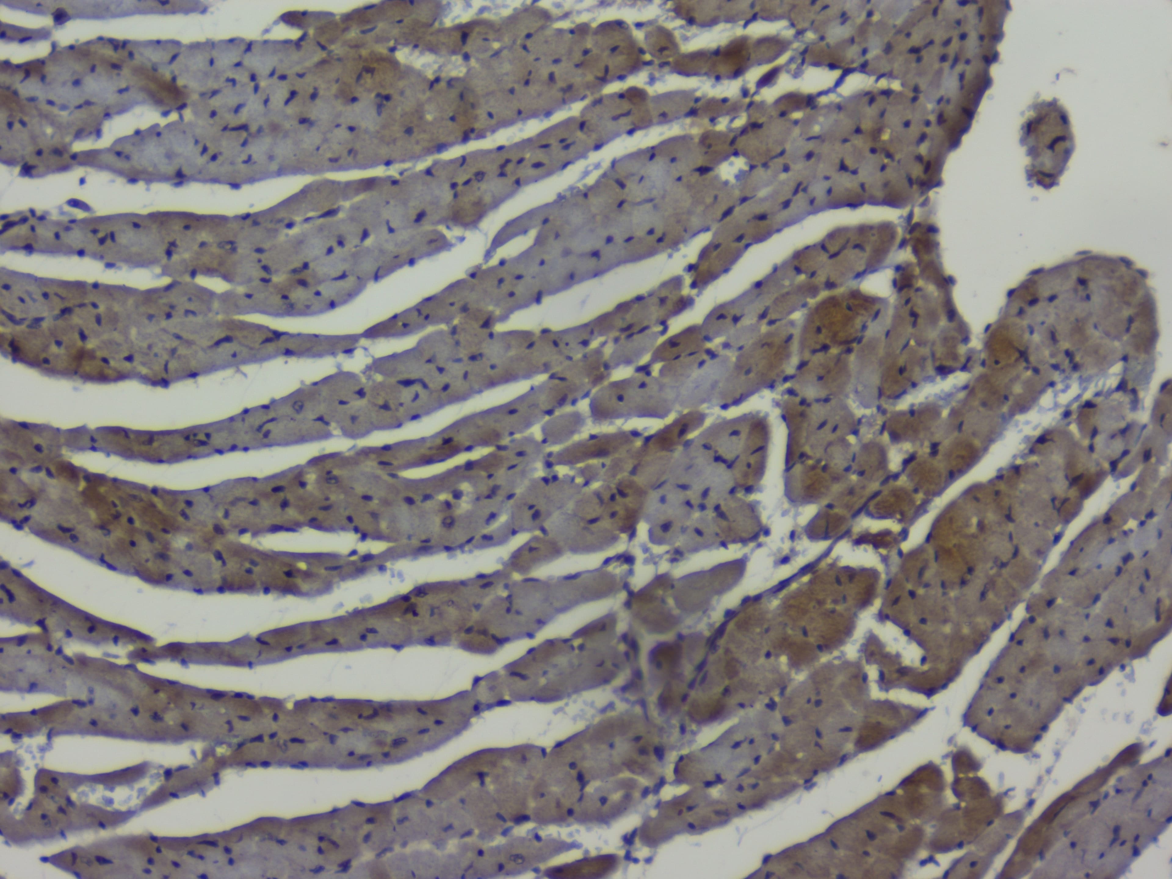 NRF1 / NRF-1 Antibody