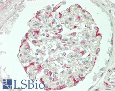 IHC-plus™ TGFB1 / TGF Beta 1 Antibody (310-390 aa, C-terminal)