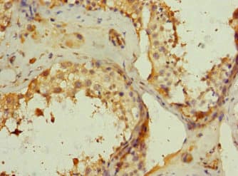 MRC2 / Endo180 Antibody
