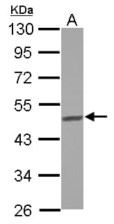 IHC-plus™ Polyclonal Rabbit anti-Human BCKDHA / BCKDE1A Antibody (C-Terminus, IHC, IF, WB)