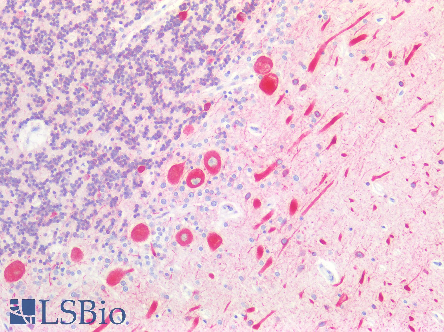 PathPlus™ CANX / Calnexin Antibody (C-Terminus)