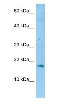 GKN2 / Gastrokine 2 Antibody (aa25-74)