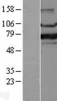 FOXP1 Protein (Over-Expression Lysate Myc-DDK (Flag))