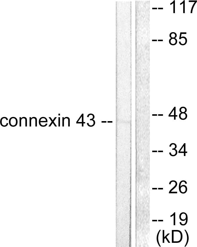 IHC-plus™ Polyclonal Rabbit anti-Human GJA1 / CX43 / Connexin 43 Antibody (aa333-382, IHC, IF, WB)