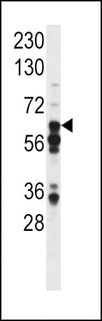 STAT3 Antibody (phospho-Tyr705)