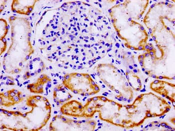 LAMA3 / Laminin Alpha 3 Antibody