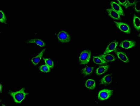 EPHA1 / EPH Receptor A1 Antibody