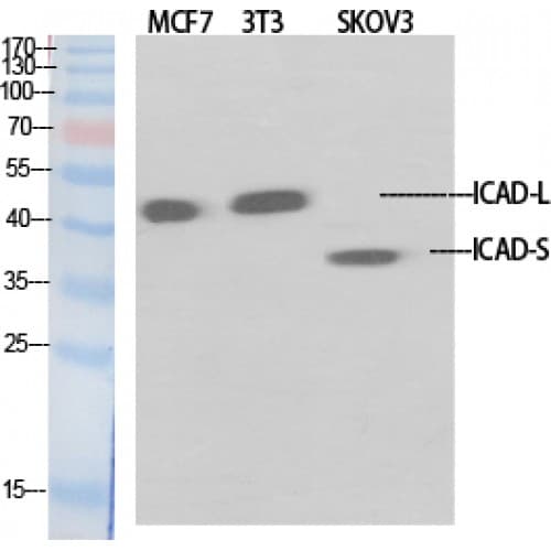 Polyclonal Rabbit anti-Human DFFA / ICAD / DFF45 Antibody (120-200 aa, Internal, IHC, IF, WB)