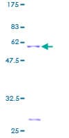 Human EIF4E2 / IF4e Protein (Recombinant GST)