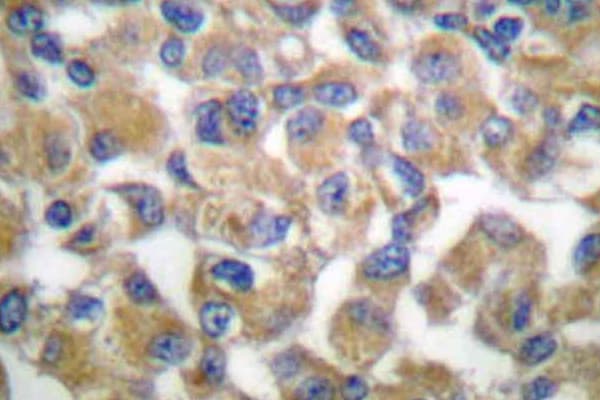 FBN1 / Fibrillin 1 Antibody (Asn2843)
