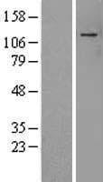 ADNP Protein (Over-Expression Lysate Myc-DDK (Flag))