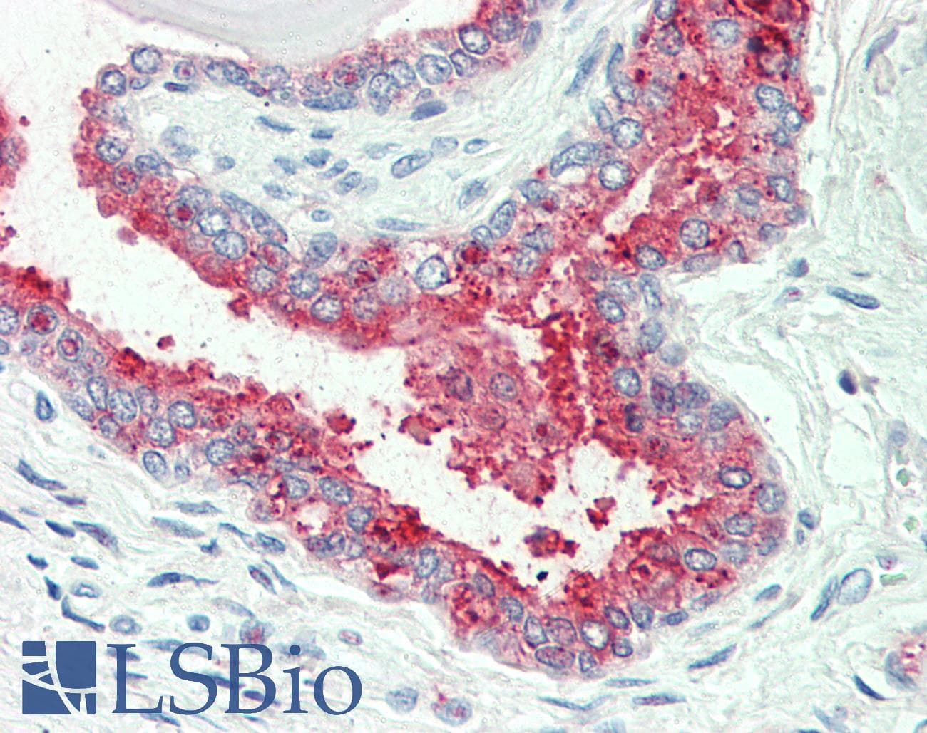 IHC-plus™ Polyclonal Rabbit anti-Human SLC12A2 / NKCC1 Antibody (Internal, IHC)